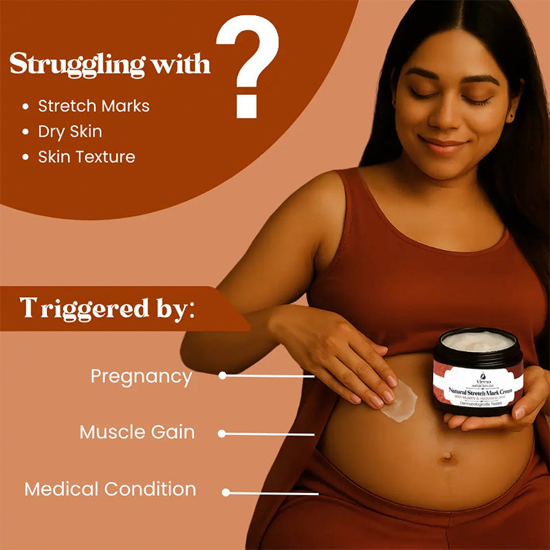 💖Mother’s Day Special: Virexo Stretch Mark Cream –––Give Mom the Skin She Deserves 💖