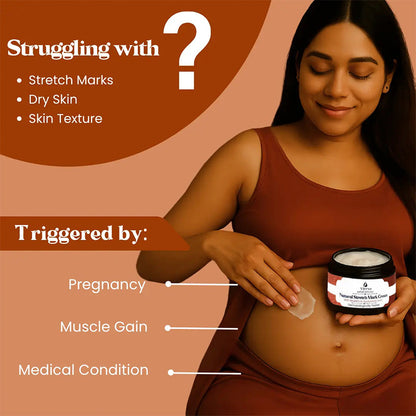 💖Mother’s Day Special: Virexo Stretch Mark Cream –––Give Mom the Skin She Deserves 💖