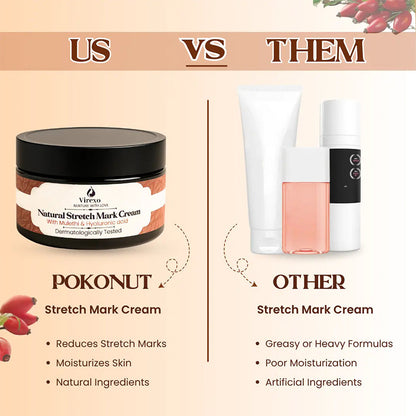 💖Mother’s Day Special: Virexo Stretch Mark Cream –––Give Mom the Skin She Deserves 💖