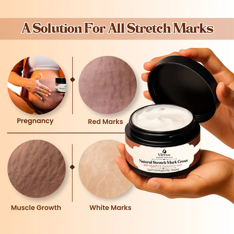 💖Mother’s Day Special: Virexo Stretch Mark Cream –––Give Mom the Skin She Deserves 💖