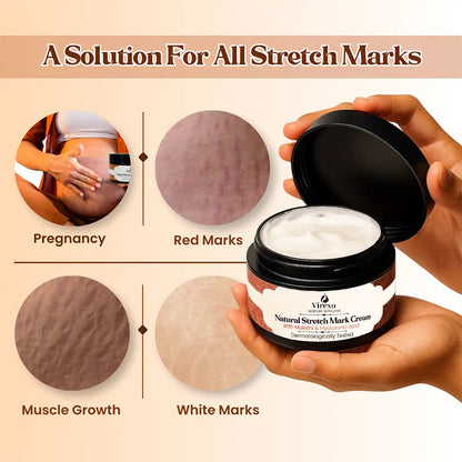 💖Mother’s Day Special: Virexo Stretch Mark Cream –––Give Mom the Skin She Deserves 💖